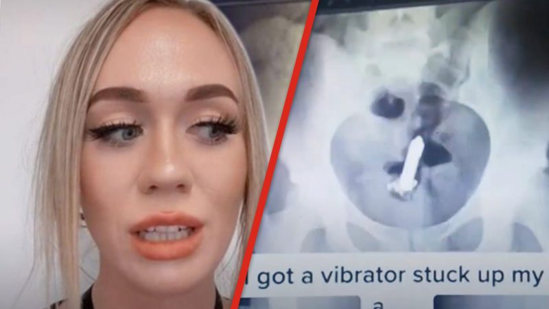 Woman gets surgery after accidentally getting a vibrator stuck in her rectum