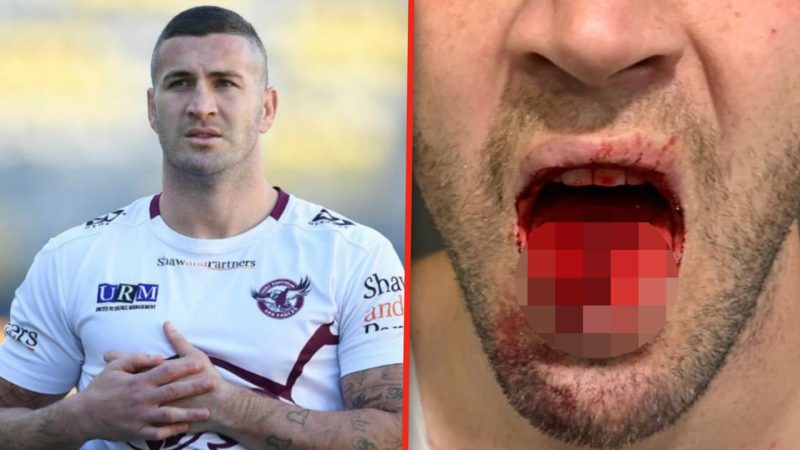 NRL star Joel Thompson shares gruesome tongue injury photo after loss to Newcastle Knights