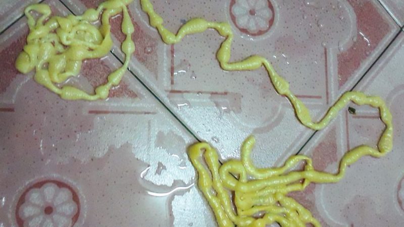 This bloke pulled a 17ft long 'alien' tapeworm out his bum