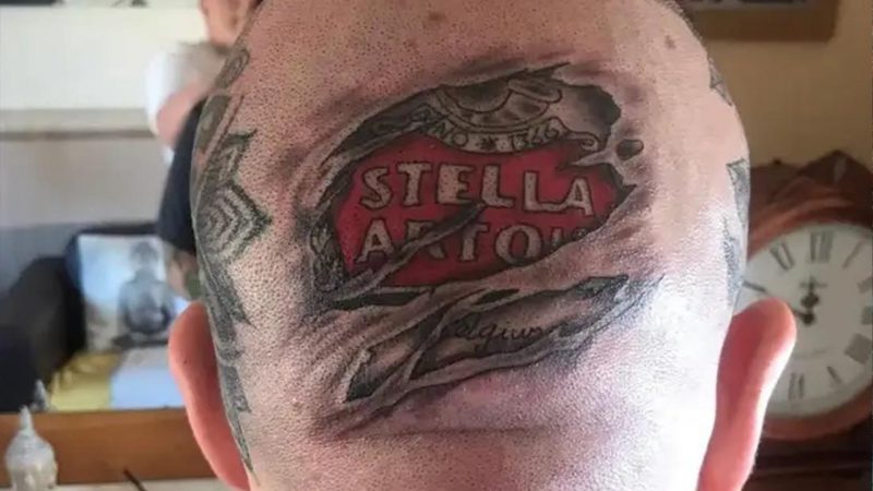 Bloke gets full-size Stella tattoo on the back of his head because his mate dared him