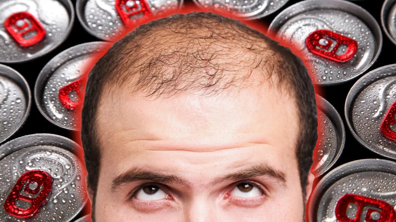 Science reckons smashing back energy drinks may lead to hair loss, so that's smoko ruined