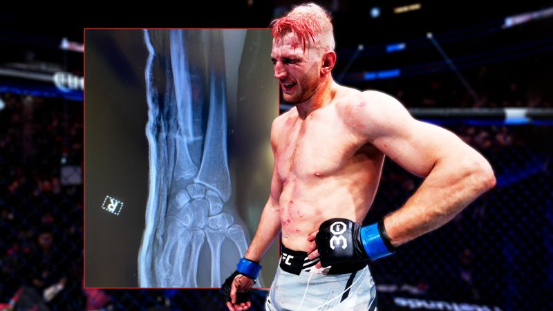 ‘Just a scratch’: Kiwi UFC battler Dan Hooker breaks arm during his bloodbath UFC 290 fight